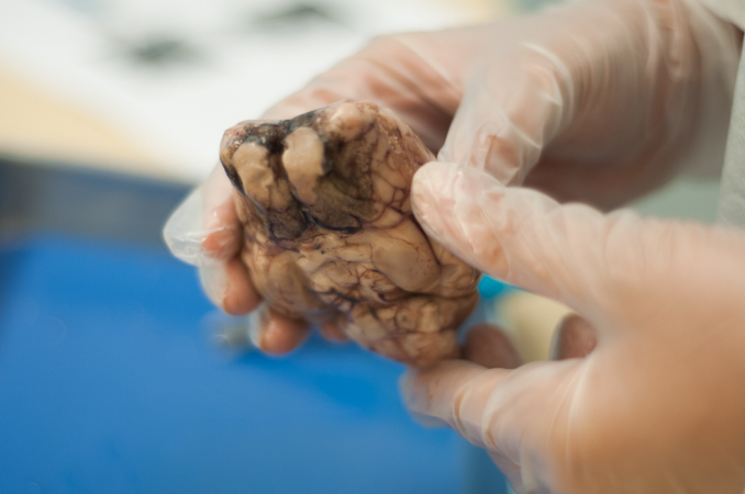 A sheep's brain on dissection day in Neuroscience class.